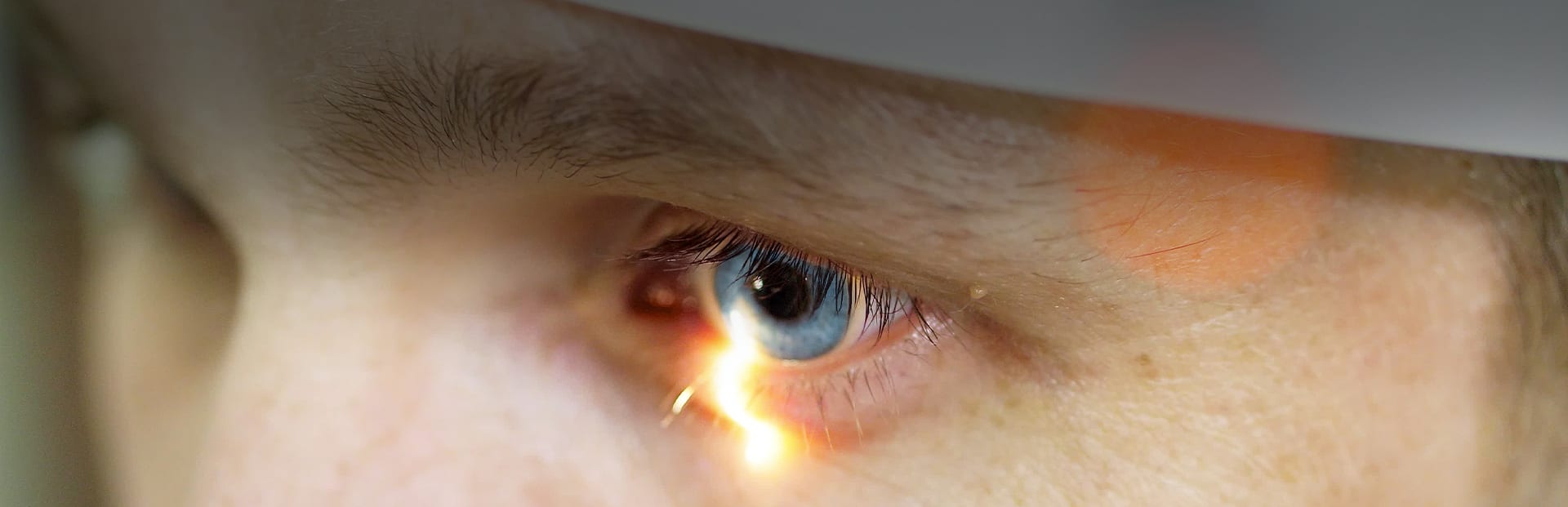 Cataract Surgery Prism Eye Institute