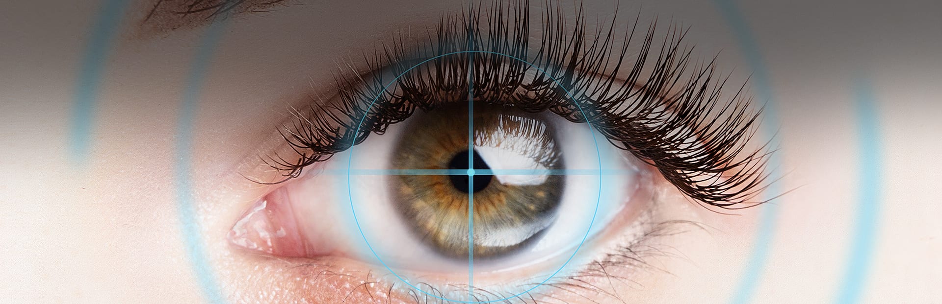 Refractive Lens Exchange Prism Eye Institute