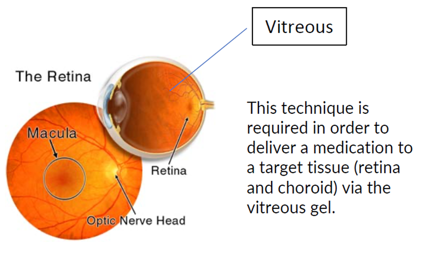This technique is required in order to deliver a medication to a target tissue (retina and choroid) via the vitreaous gel.